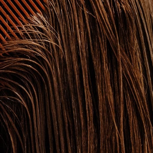 Unmasked Ultimate Hair Restoration at Unmasked Aesthetics in Vancouver, WA
